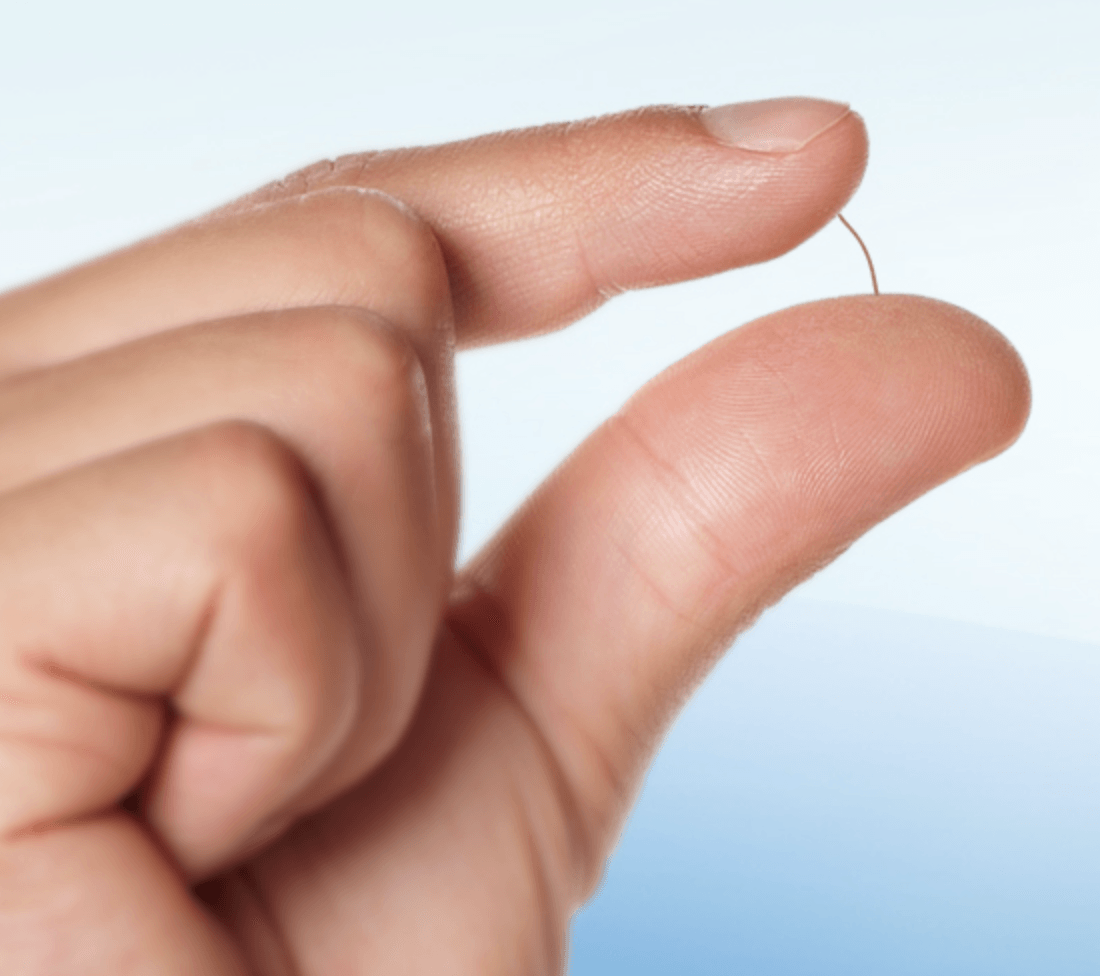 XEN-do-tamanho-de-um-cilio-implante-para-glaucoma-1 XEN-do-tamanho-de-um-cilio-implante-para-glaucoma-1