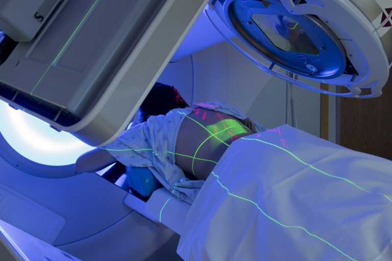 Radioterapia - mulher recebendo radiação para combater câncer